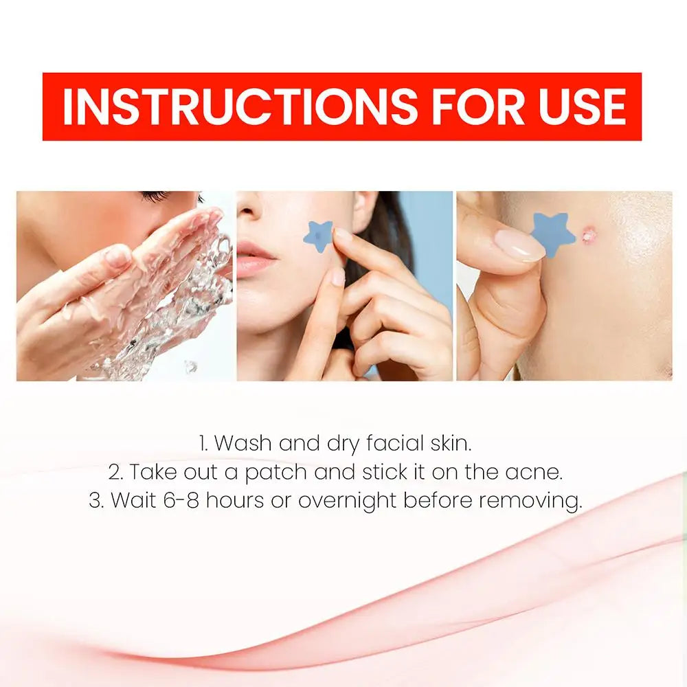 Star Acne Patches (200pcs)