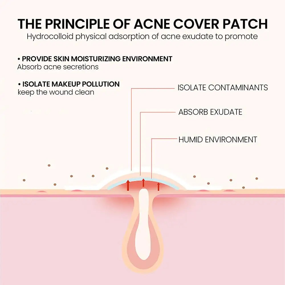 Star Acne Patches (200pcs)