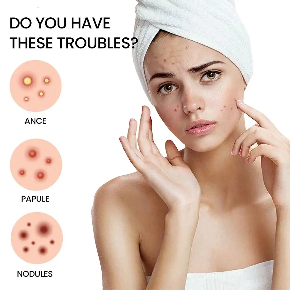 Star Acne Patches (200pcs)