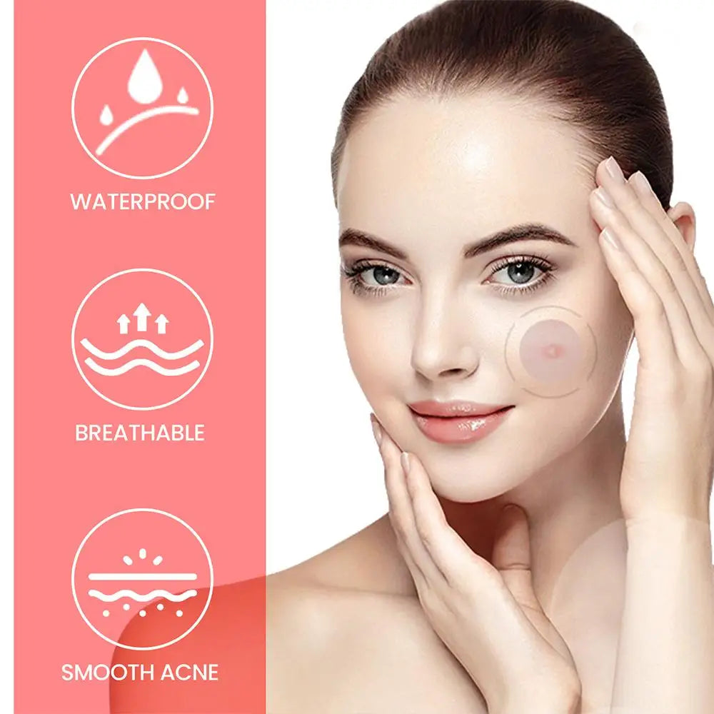 Star Acne Patches (200pcs)