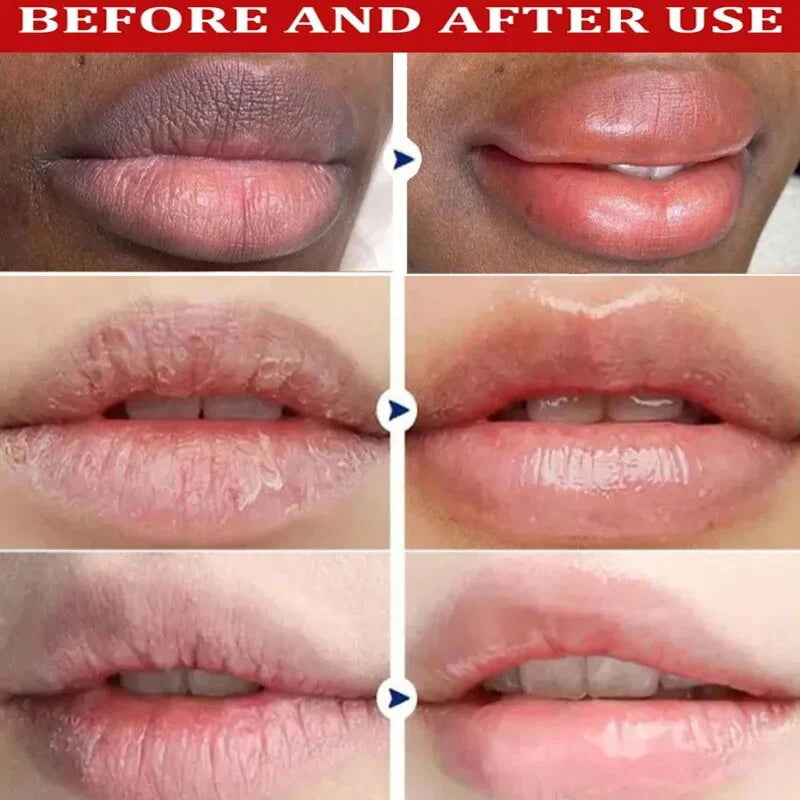 Brightening Lip Repair Balm (Hydrate & Smooth Lips)